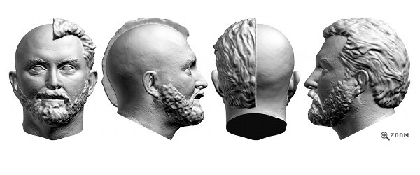 3D Head Scan - Hair Treatments